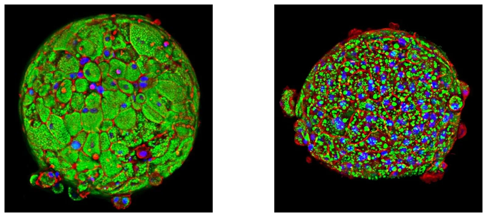 Spheroids of liver tissues with high fat content and low fat content